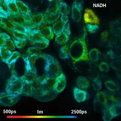 TM image from simultaneous FLIM of NAD(P)H and FAD